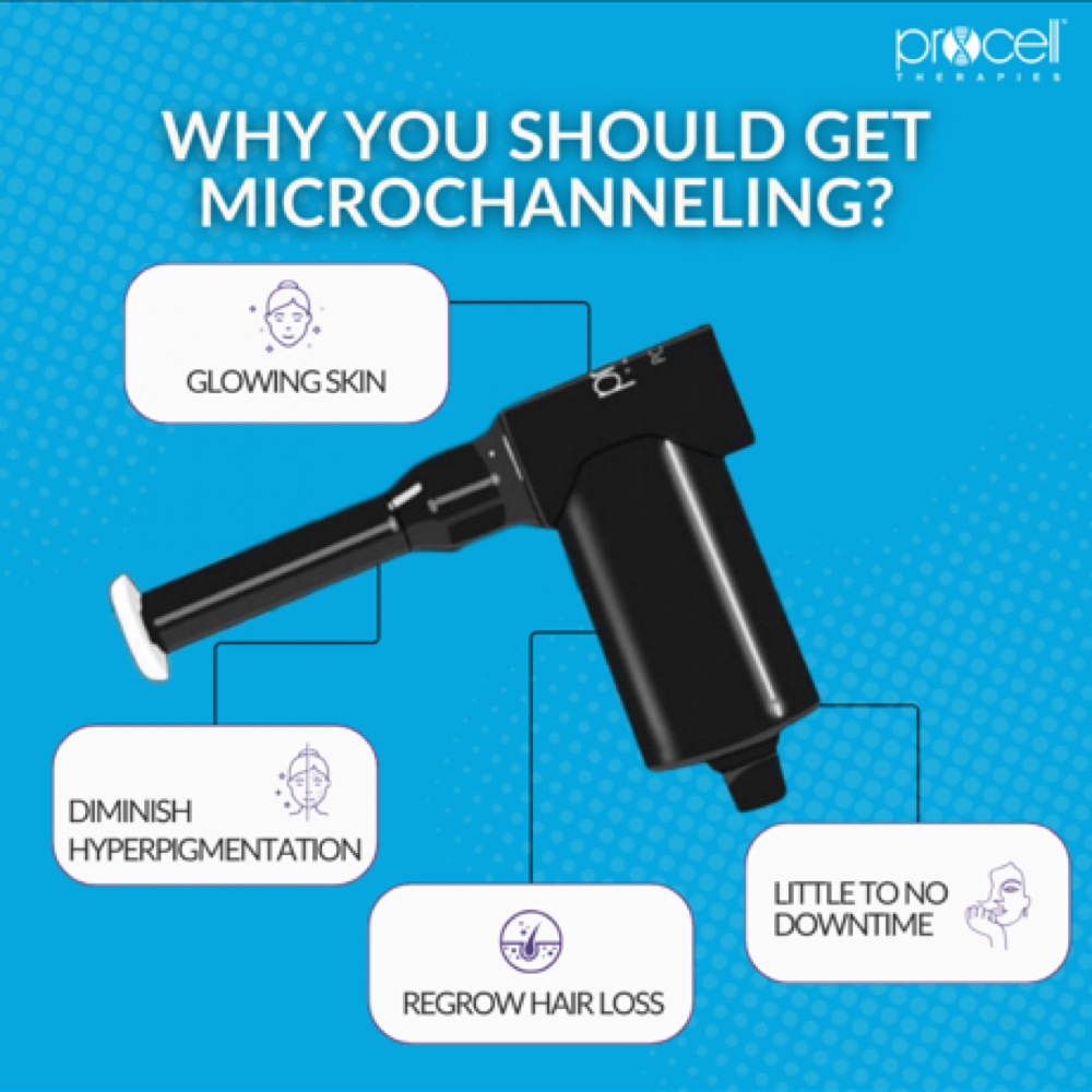 Procell Microchanneling Face/Neck at Dreamland Health and Wellness in Indianapolis, IN