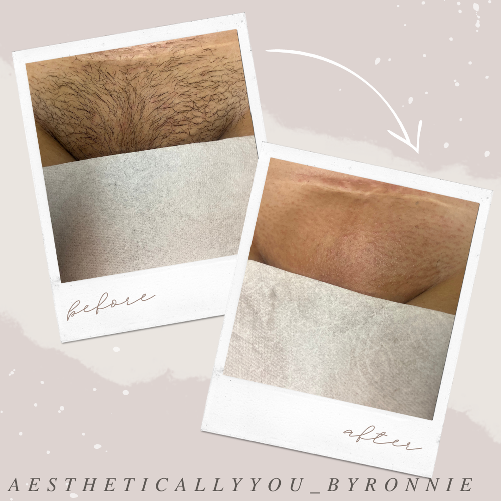 Brazilian Waxing at Aesthetically You in Modesto, CA
