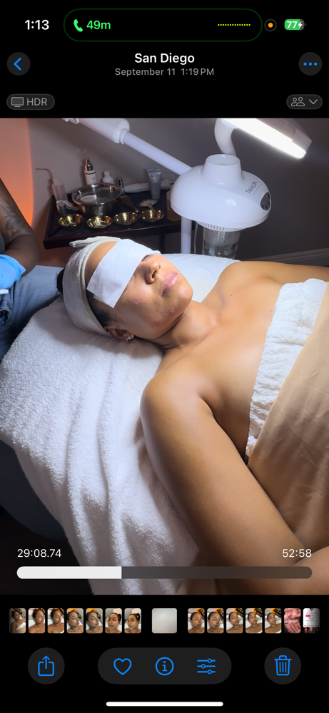 Acne Clear Upgrade Treatment