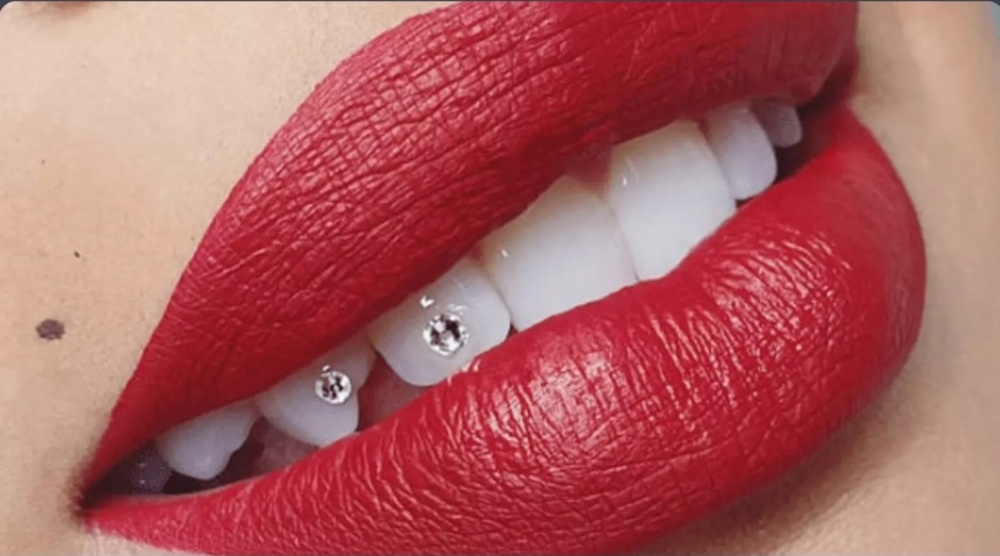 💎🦷March Special🦷💎
