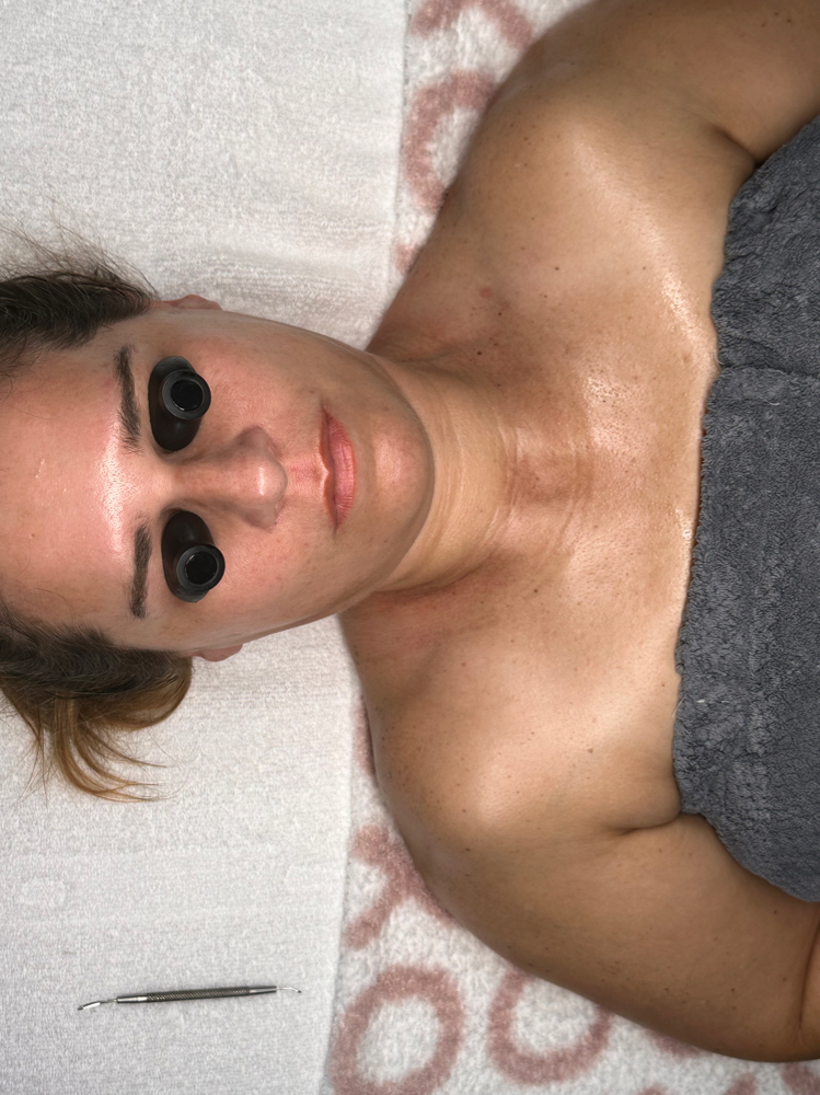 DLA Facial