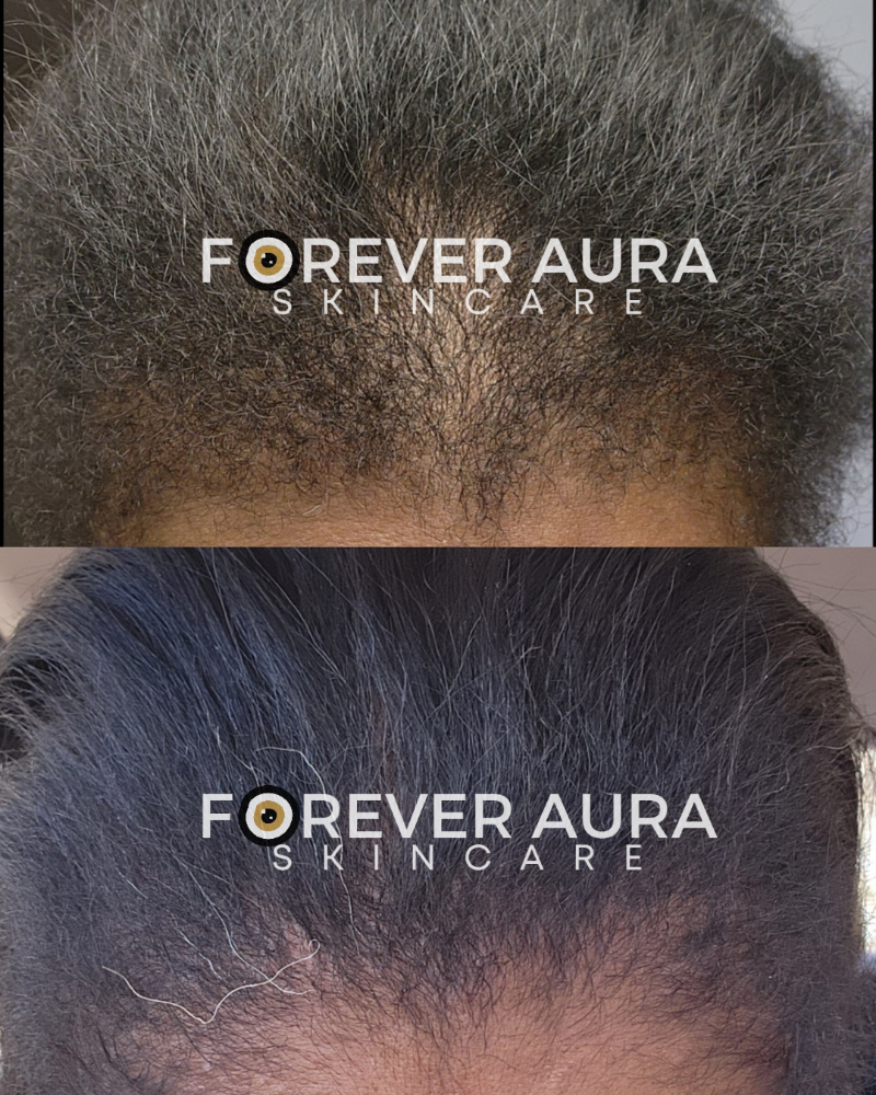 Herbal Hair Boost