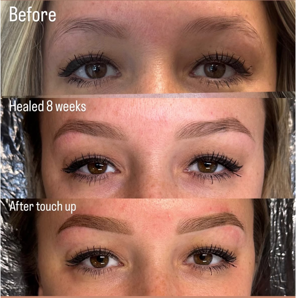 Brow 8-12 week follow up