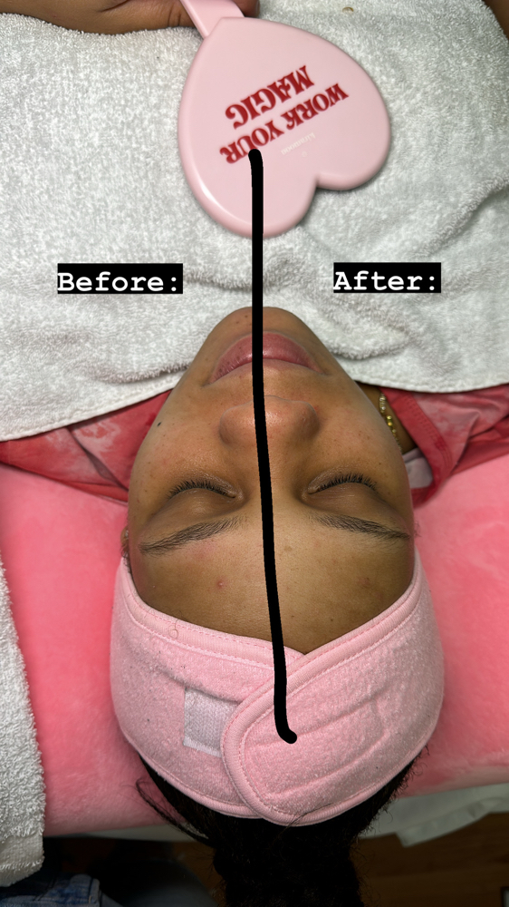 Double Exfoliation Facial