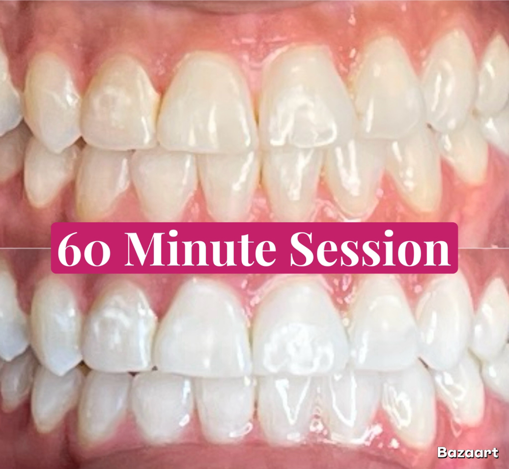 60 Minute Whitening