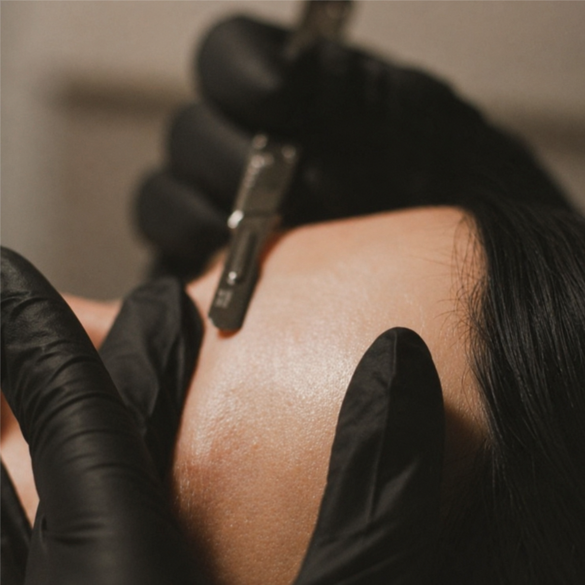 Dermaplane Facial at Bituin Skin in San Diego, CA