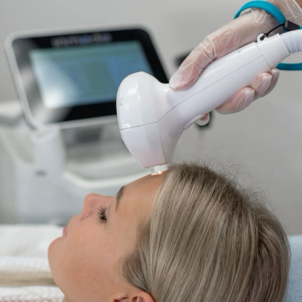 IPL Acne Facial at Luxe Level Aesthetics in Darien, CT
