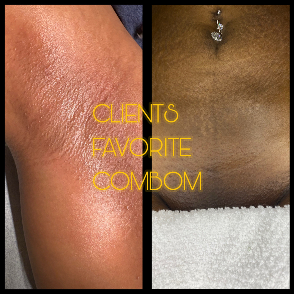 Brazilian Wax+Underarm at BARE AND SMOOTH ESTHETICS LLC in Lombard, IL