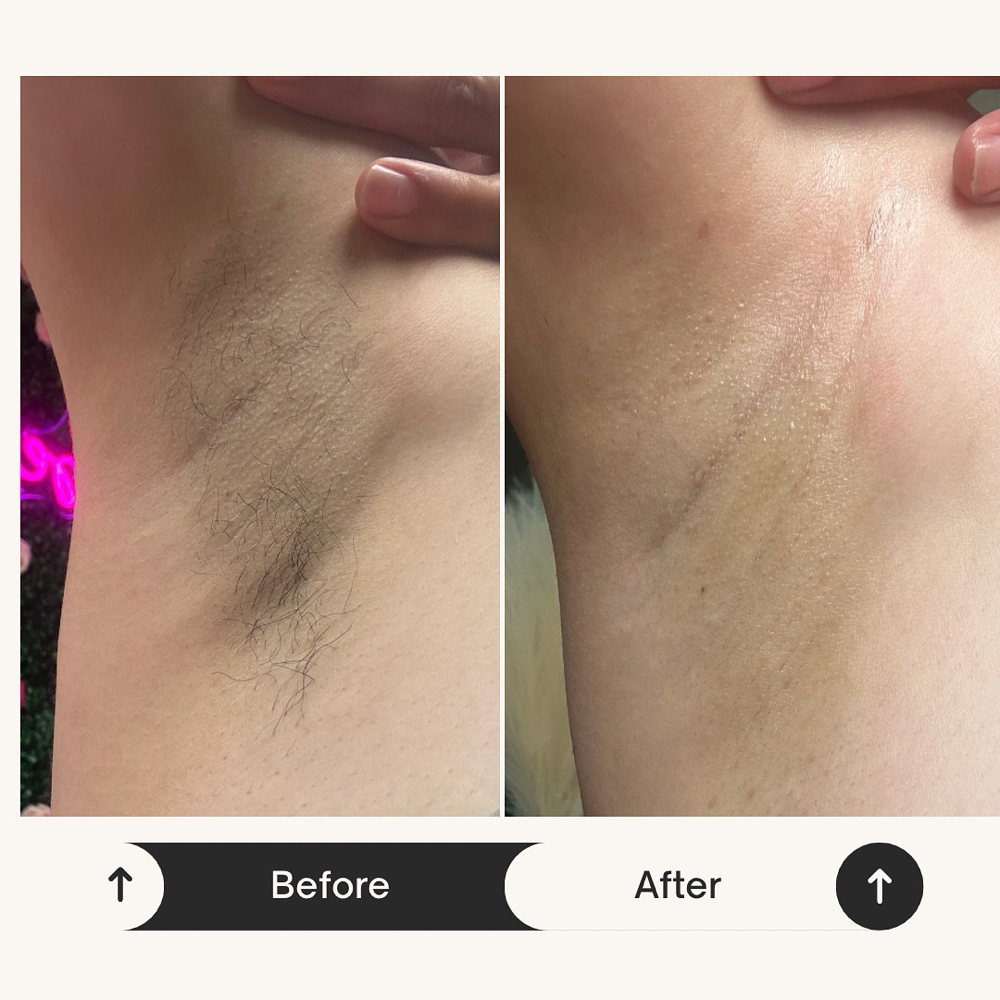 Underarm Wax at WaxPlugLaura in Lincoln, NE