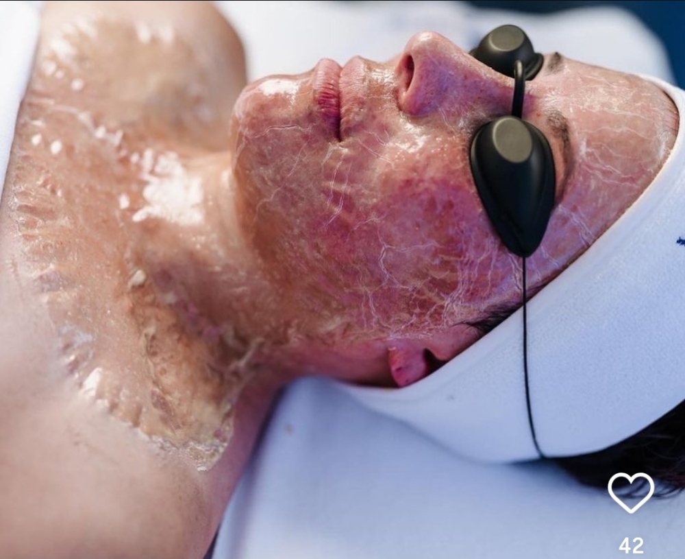 Firming Peptide Facial at VONA Skincare in Charlotte, NC