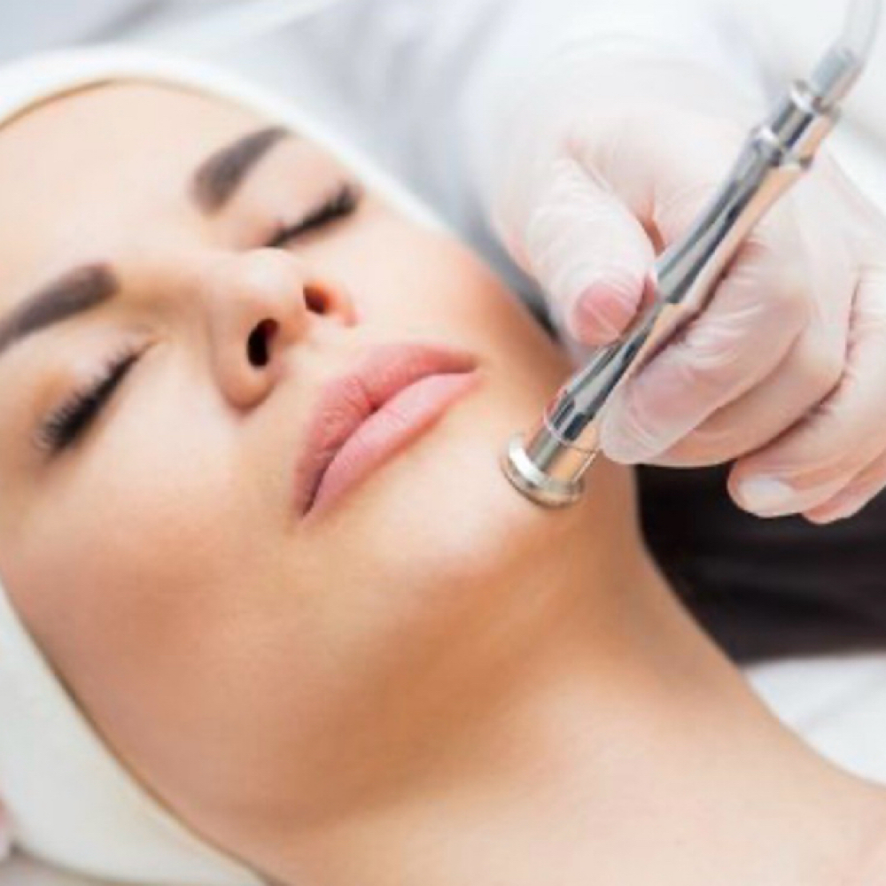 Microdermabrasion at Prism Beauty in San Juan Capistrano, CA