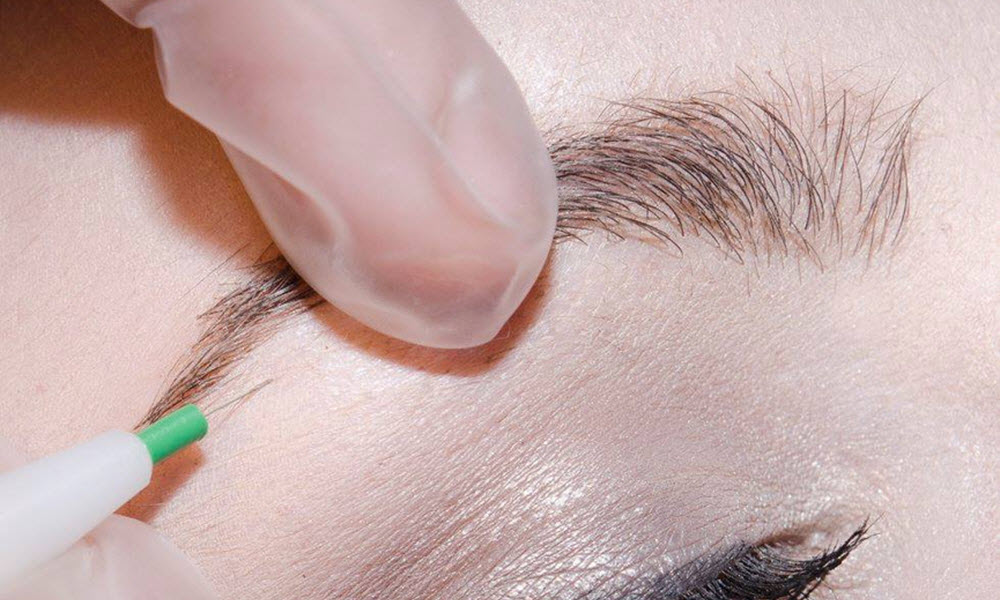 Electrolysis