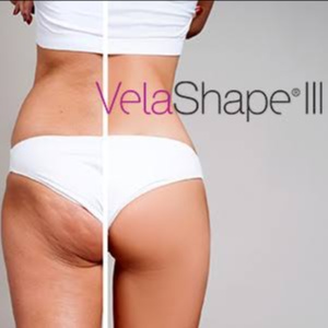 Skin Tightening VelaShape at Zen Beauty in McAllen, TX