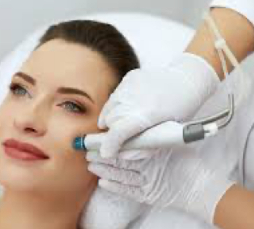 Hydra~Dermabraision facial