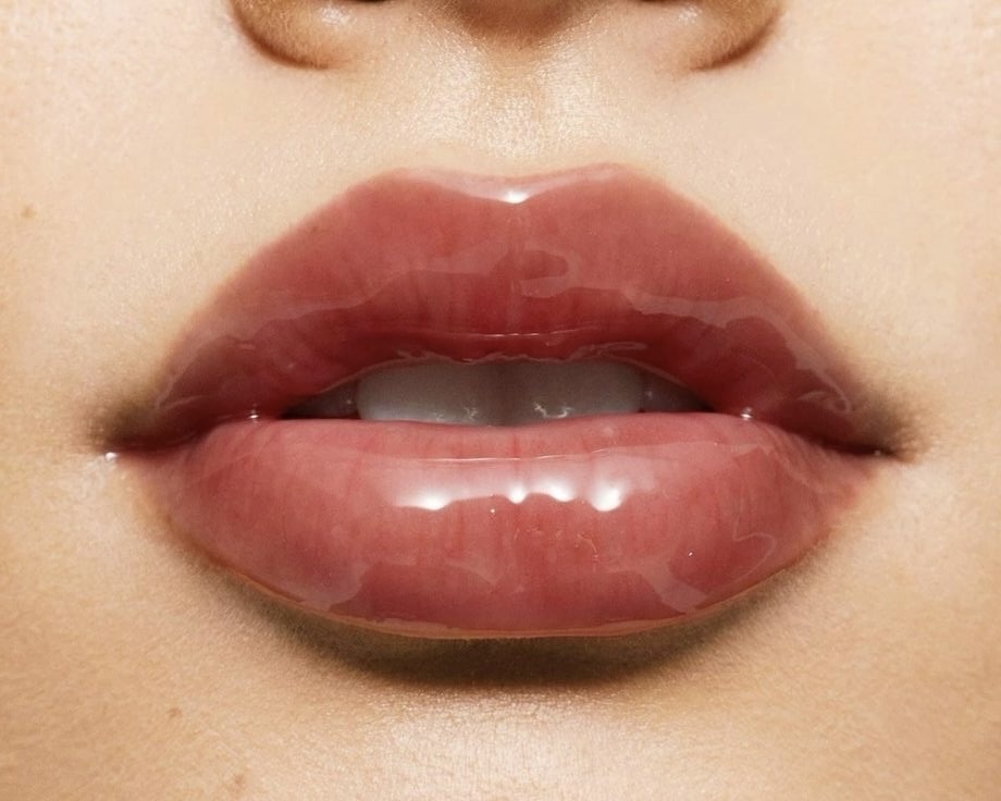 1.1ml of Hyaluronic Acid