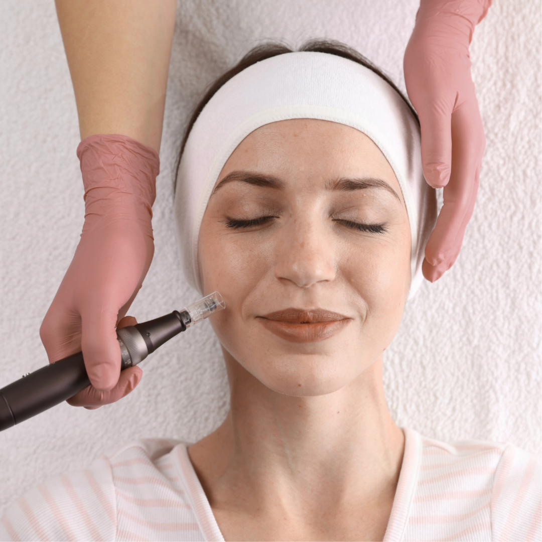 Microneedling at Authentic Beauty in Canon City, CO