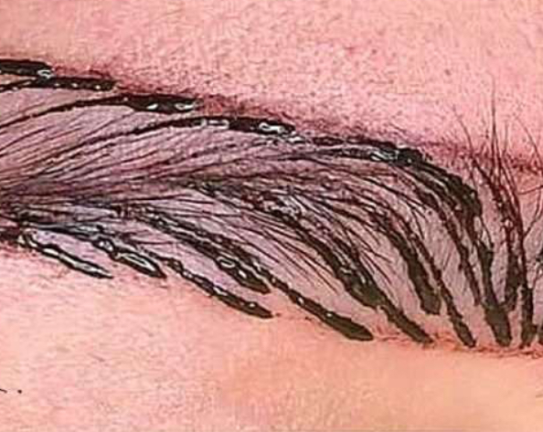 Microblading