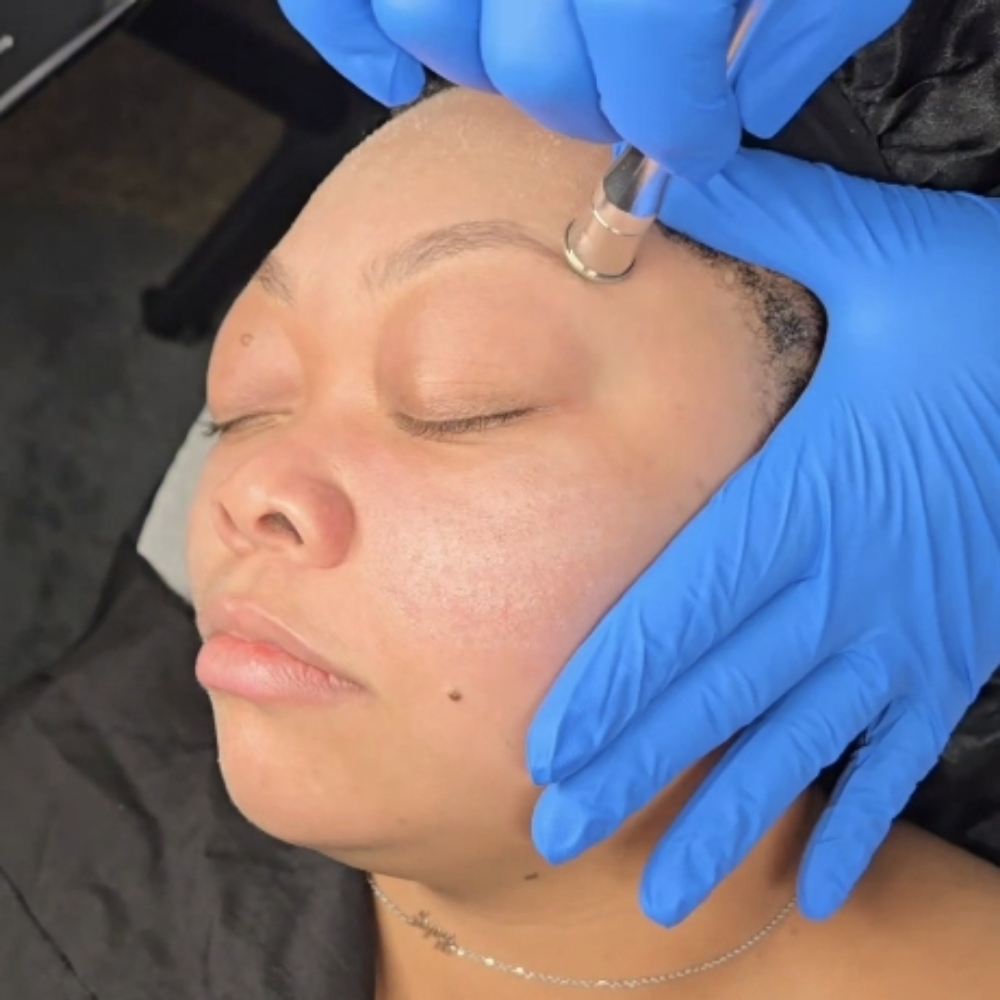 MicroDermabrasion Facial Add-on at Stae Awhile X LA Perez in Pueblo, CO