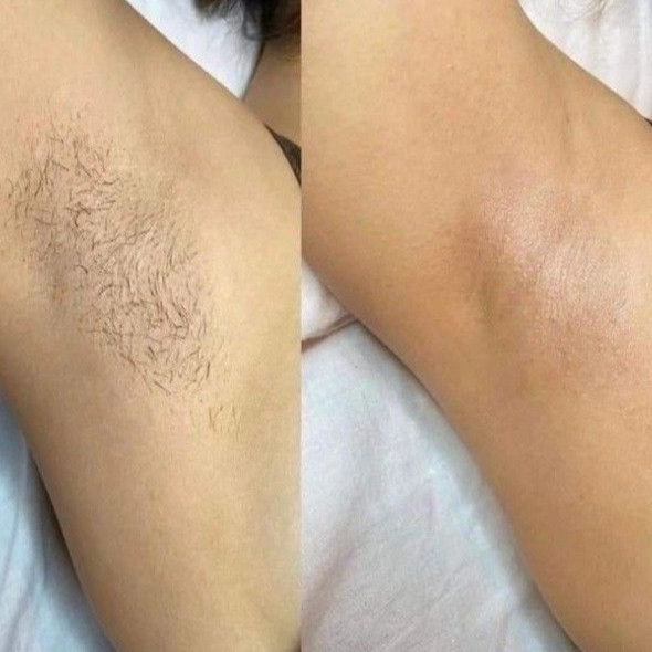 Underarm Wax at JE Beauty & spa in duluth, GA