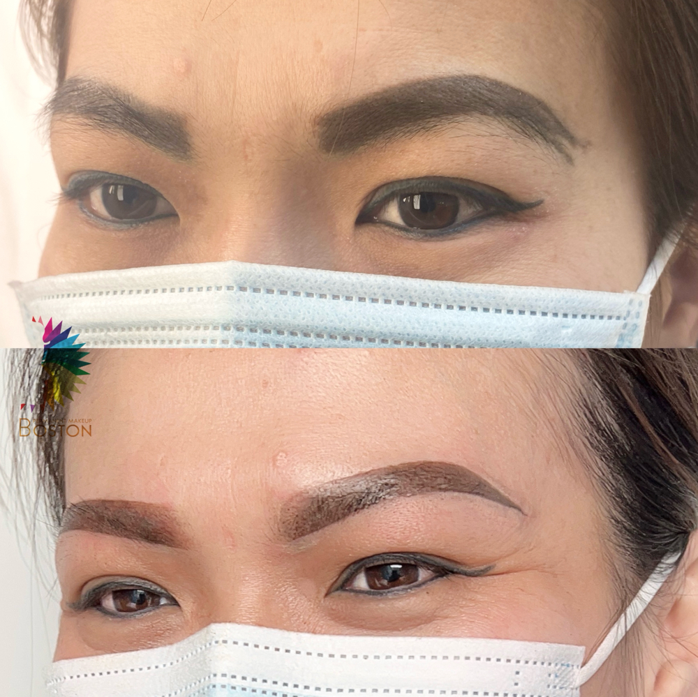 Eyebrows Removal