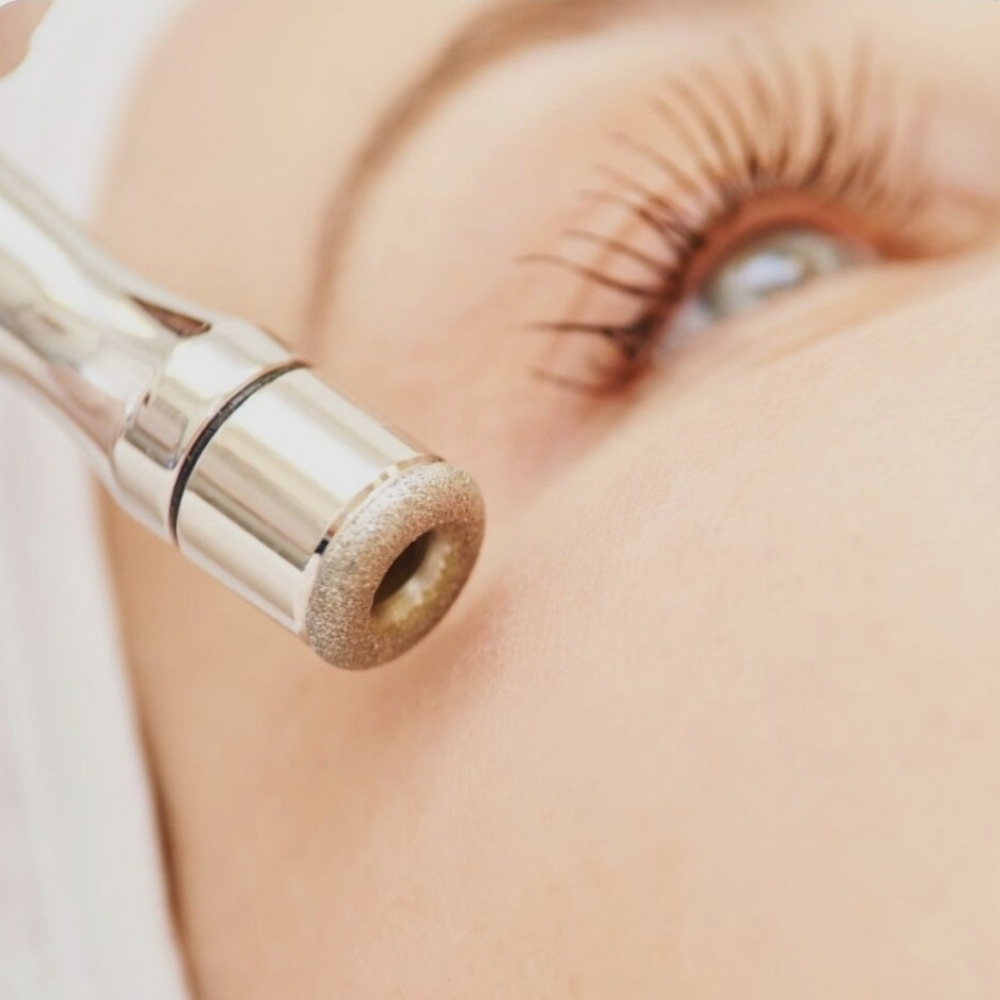 Diamond Microdermabrasion Facial at let's face it by Ash in Evans, CO