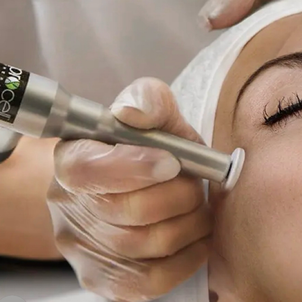 ProCell™ Microchanneling at Carisma Esthetics in Hurst, TX