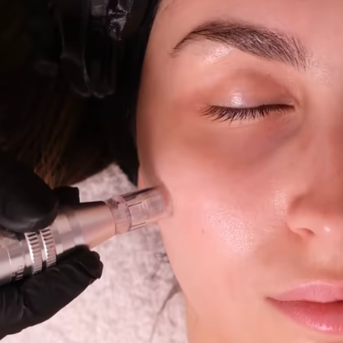 Nano Infusion (Add-on)