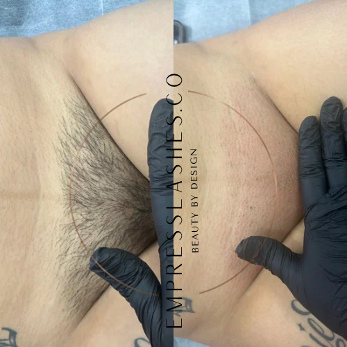 Brazilian Wax