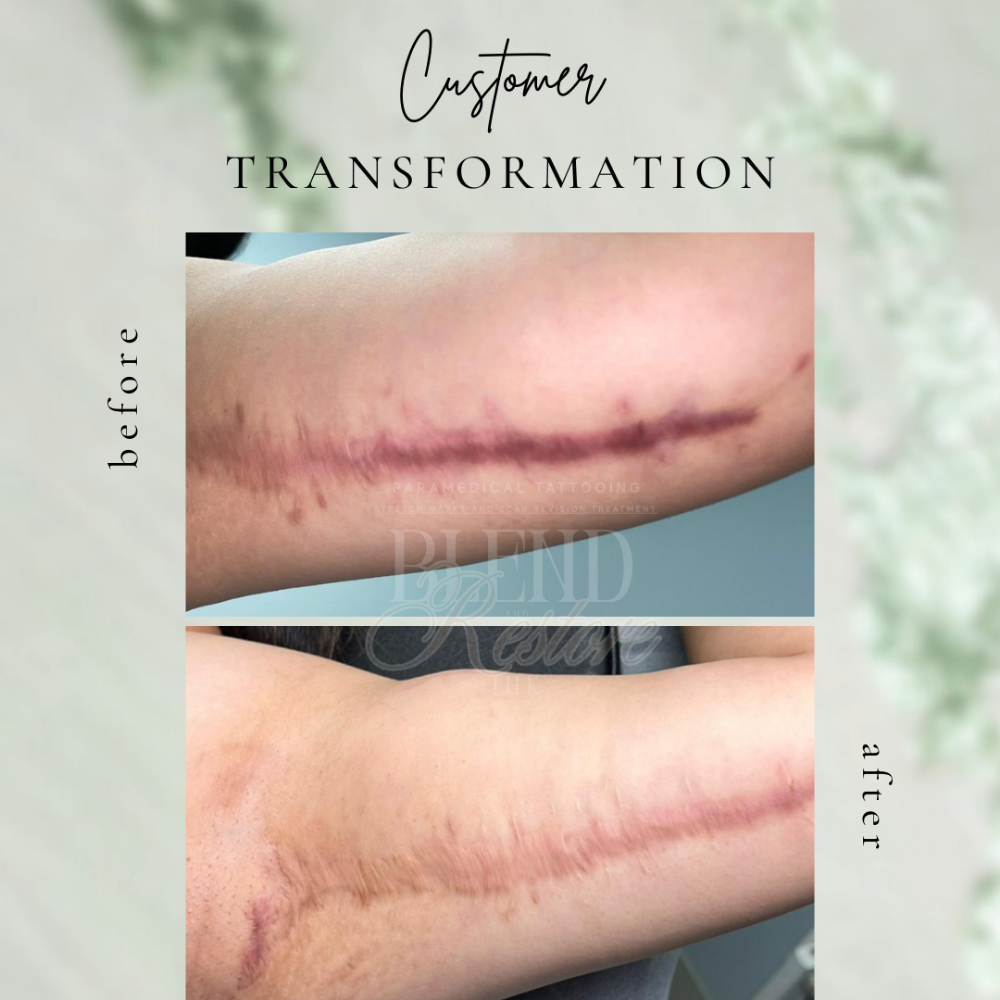 Scars 5 inches +