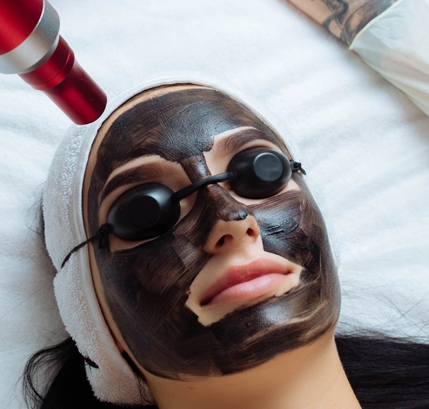 Hollywood Peel
