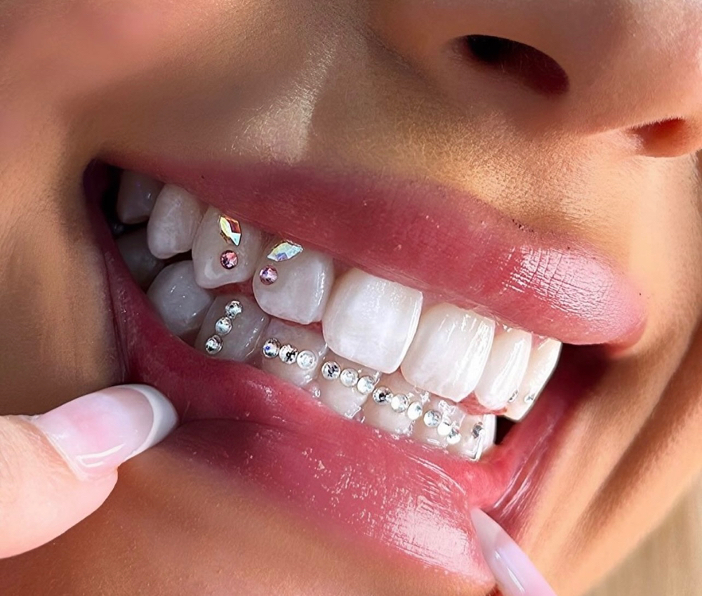 Tooth Gems