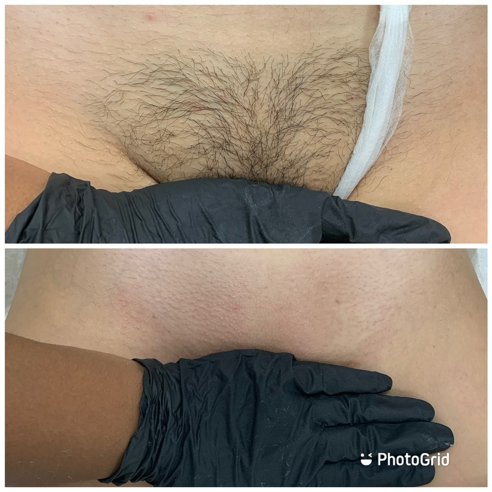 Brazilian at Sweet Escape Studio in Matteson, IL