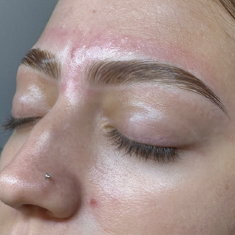 Bare Lami Model at Synskn Esthetics in Largo, FL