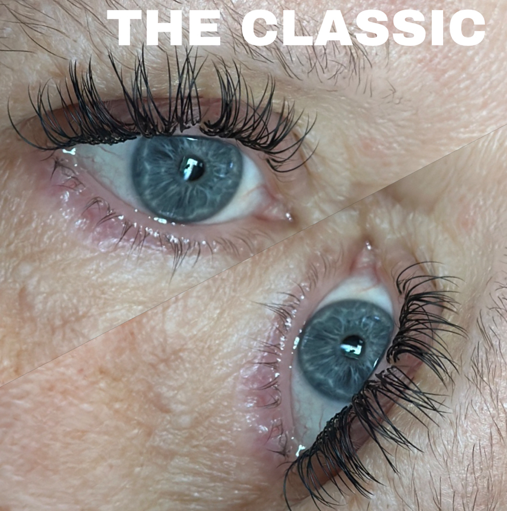 Classic Set
