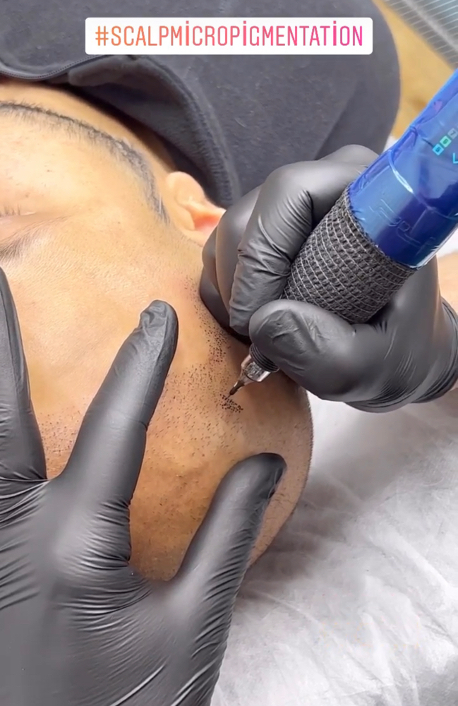 Scalp micro pigmentation