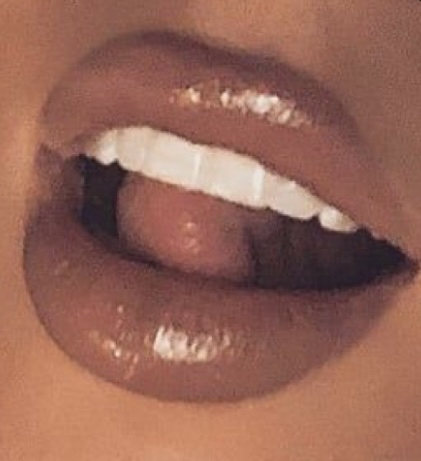 Premium Teeth Whitening