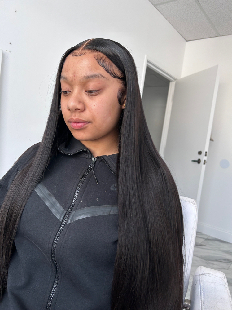 Frontal Installment