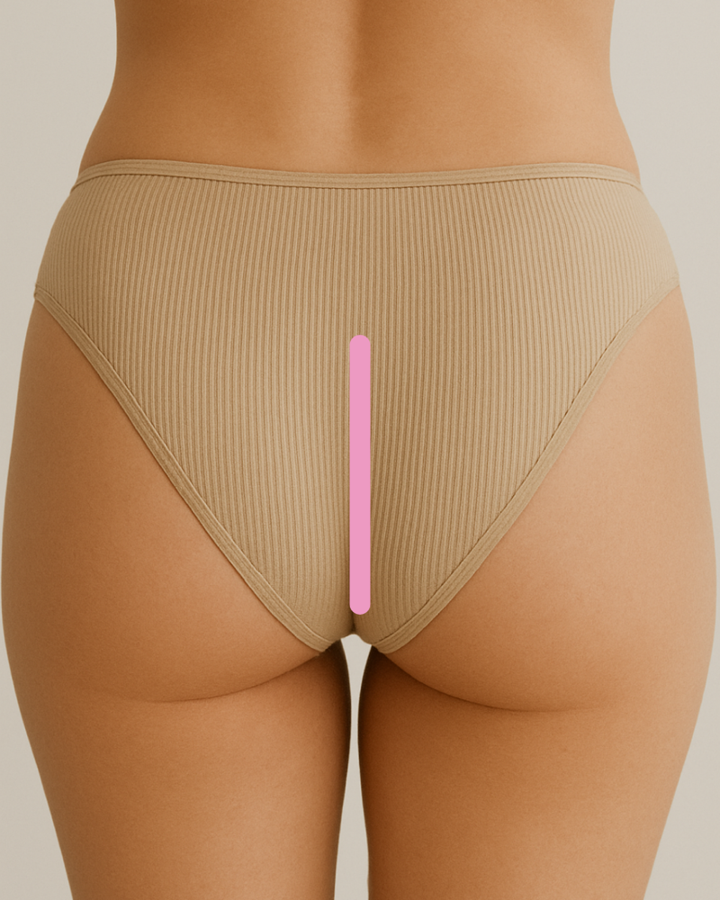 Inner Buttocks at Bare Beauty Haus in North Richland Hills, TX