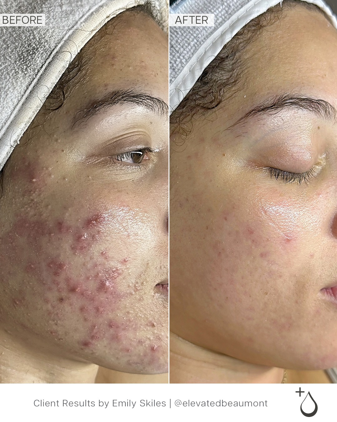 Face Reality Skin Consult at The Body Shop Spa in Traer, IA