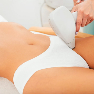 33-Laser Hair: Legs, Brazilian