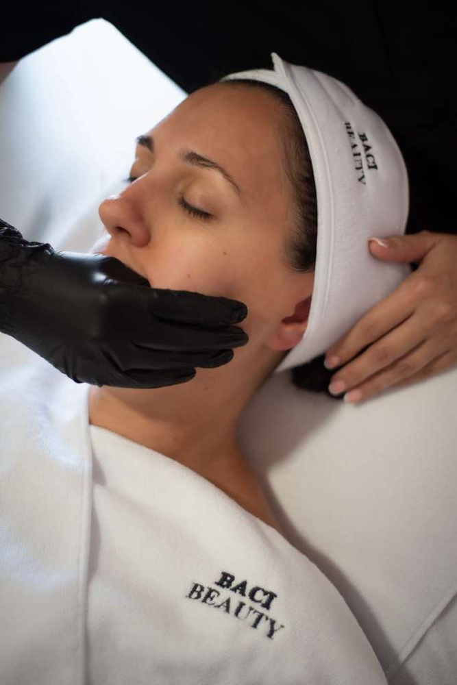 Buccal Facial Sculpting at Baci Beauty in Stuart, FL