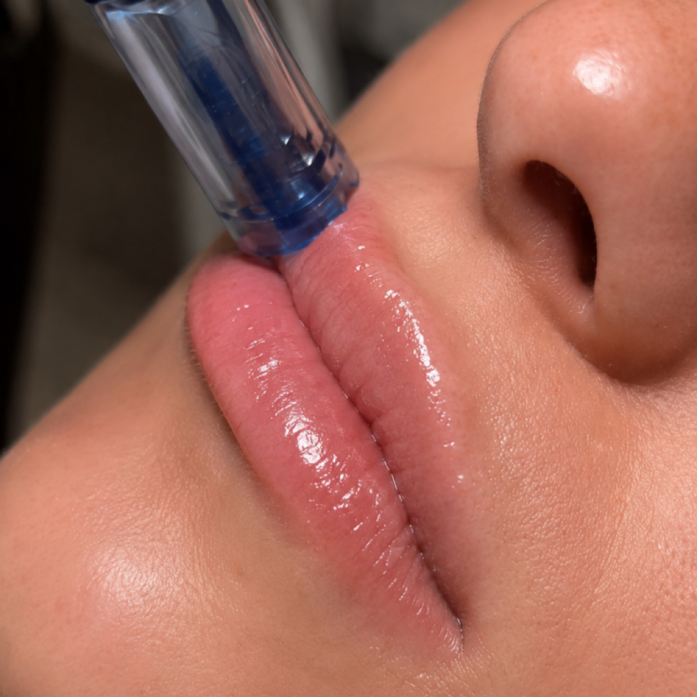 Nano Infusion Lip Perk at Society Skin Lab in Arlington, TX