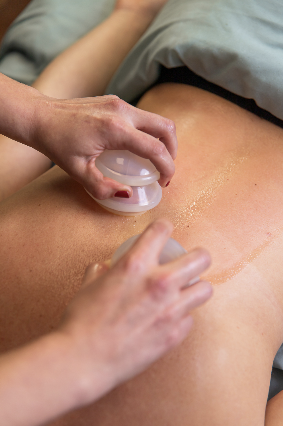 Cupping Therapy