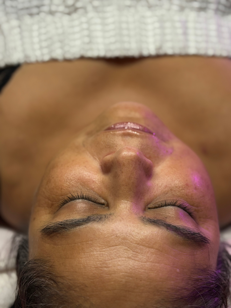 ✨Full Face Radiance✨