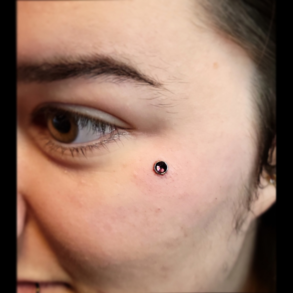 Dermal