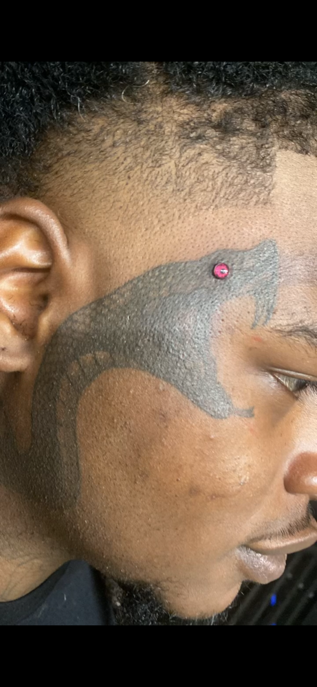 1 Dermal