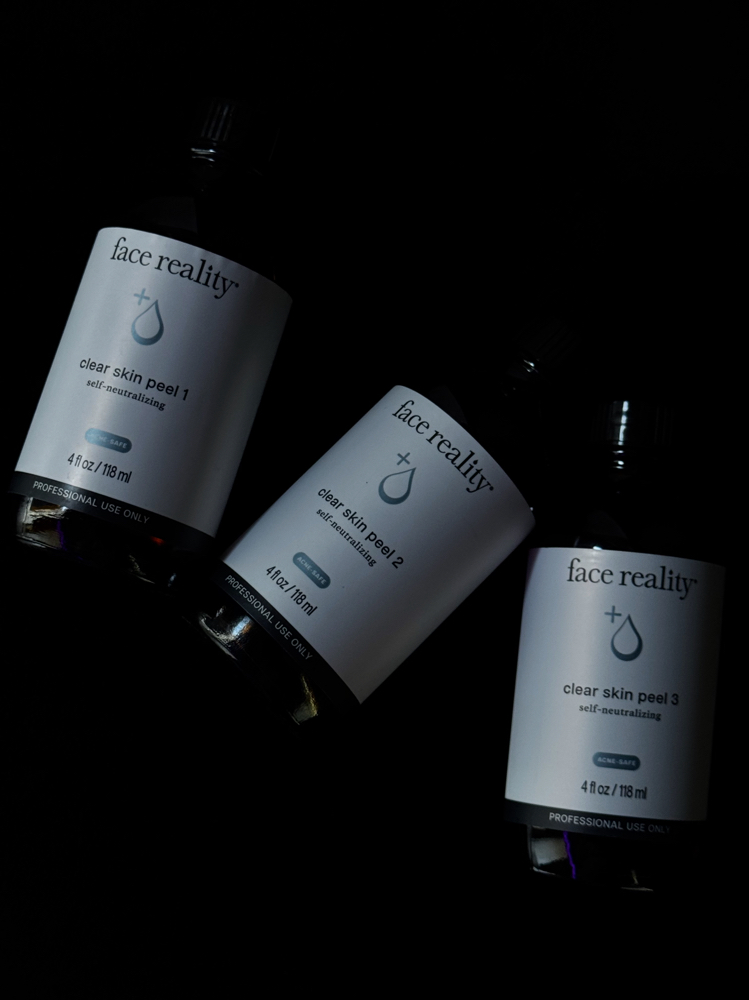 Acne Consult with First Treatment