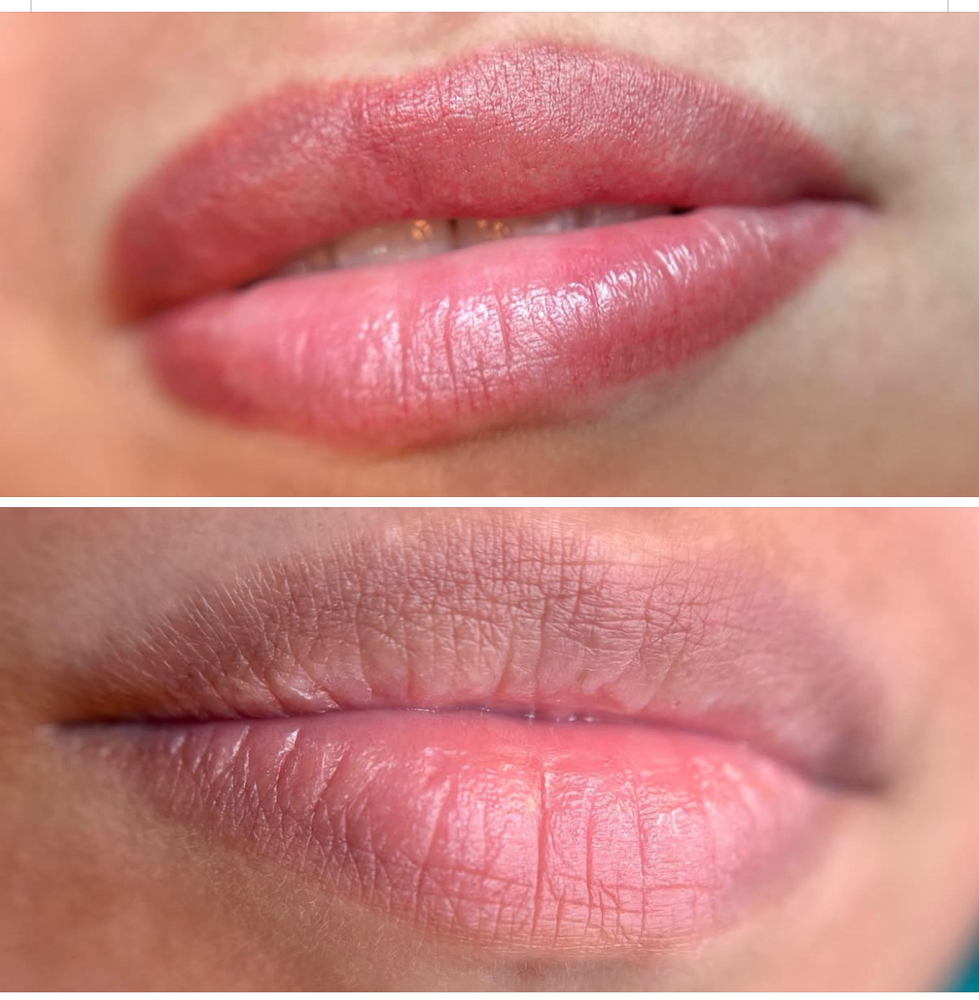 Dark Lip Neutralization