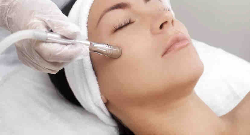 Microdermabrasion Facial - Just ...
