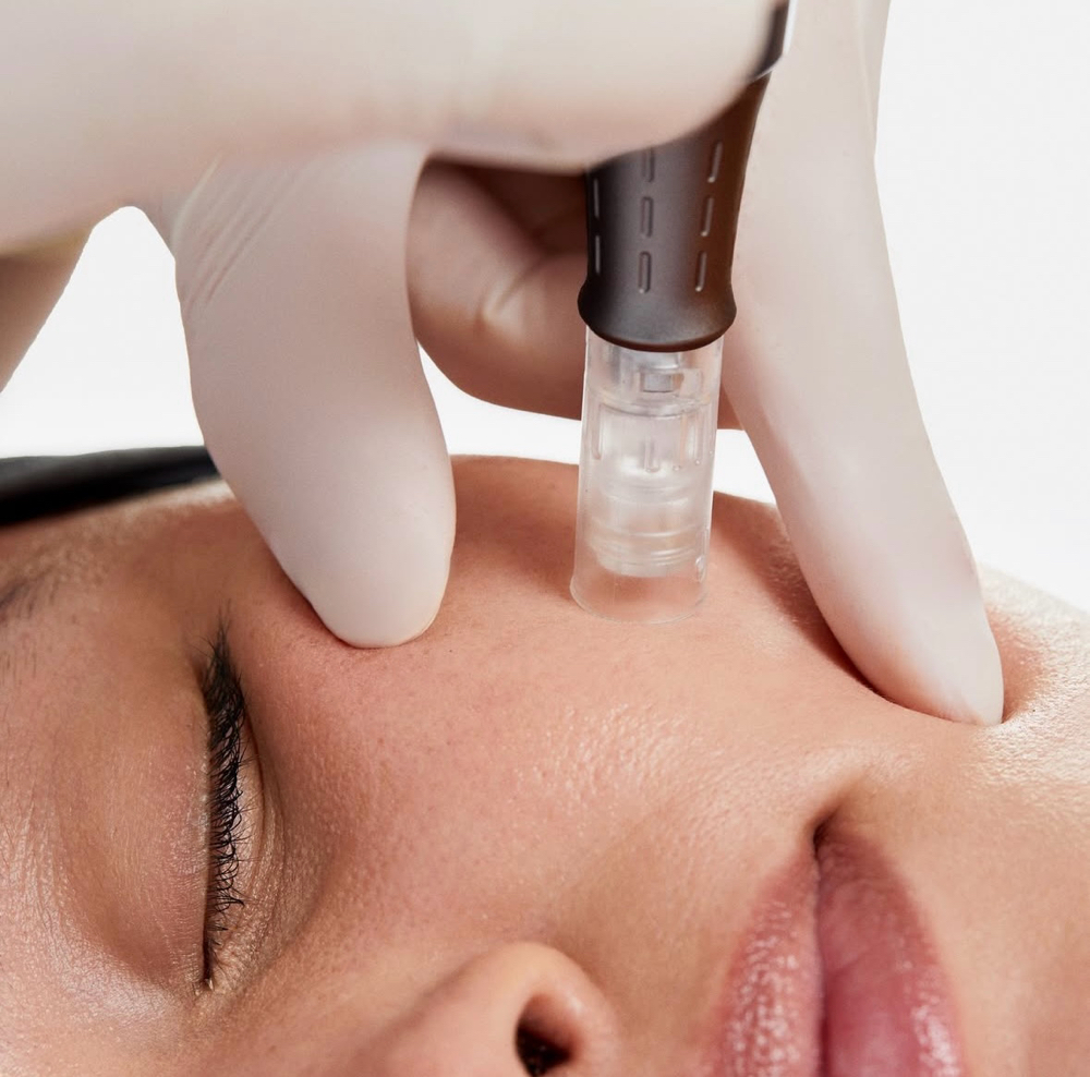 Nano Infusion/ Luminfusion Facial